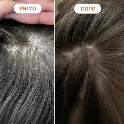 GlowHair ™  - Capelli più lunghi, più forti e più folti in 6 settimane